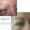 Hairstroke eyebrow enhancement before and after