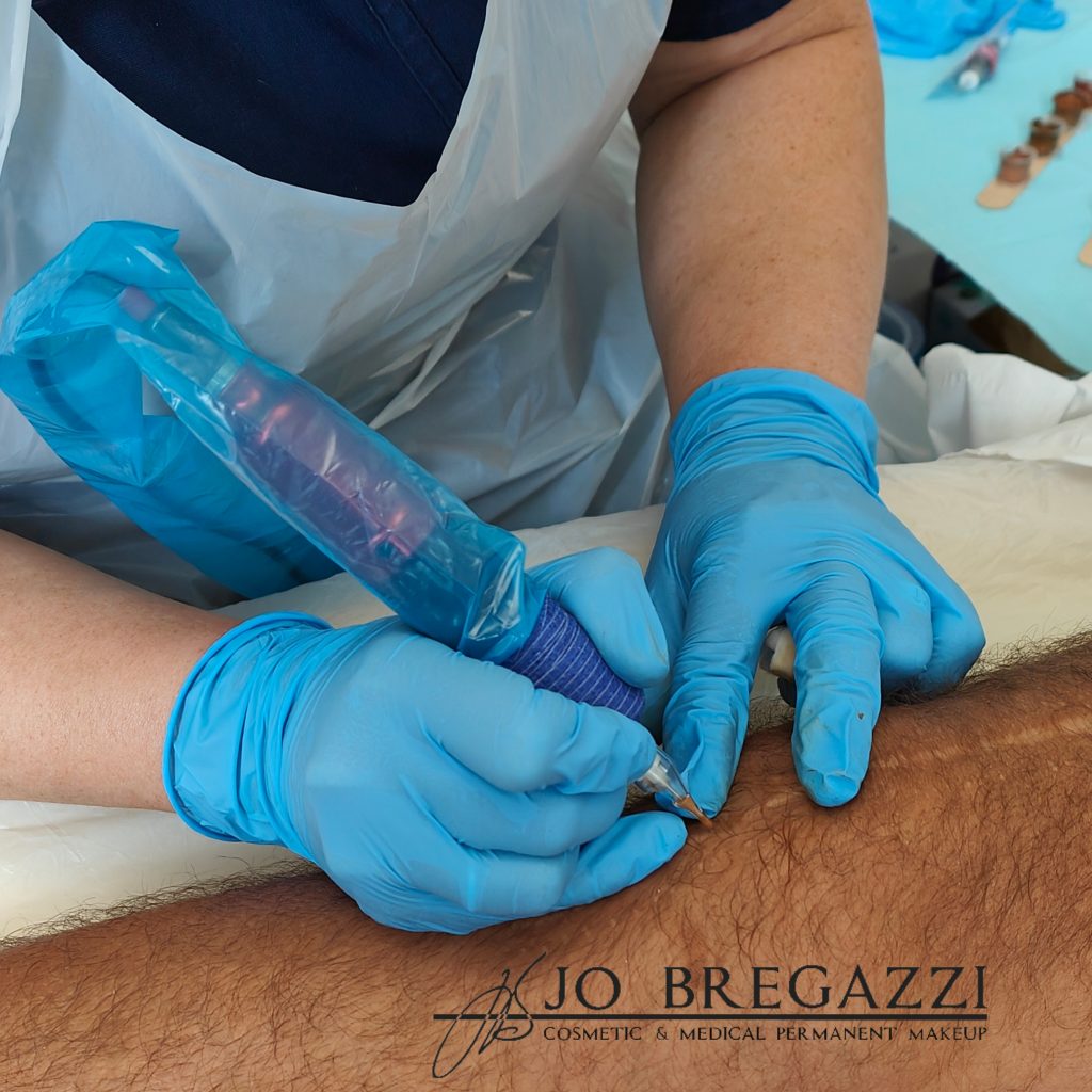 Medical tattooing with skin toned inks for scar camouflage,skin grafts, burn scars, stretch marks by Jo Bregazzi 