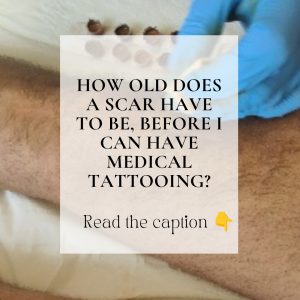 How old does a scar have to be for medical tattooing?